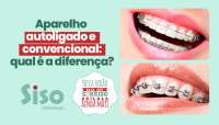 Aparelho autoligado e convencional: qual é a diferença?