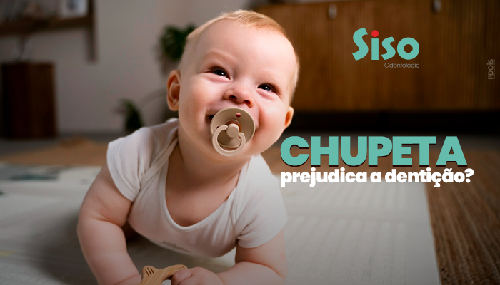 CHUPETA PREJUDICA A DENTIÇÃO?