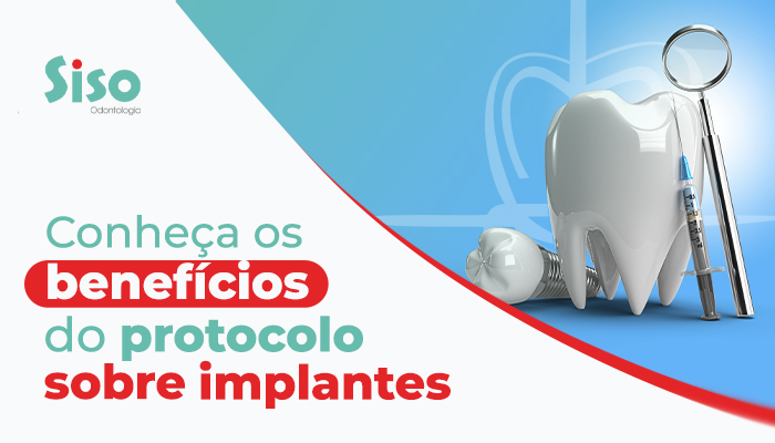 Conheça os benefícios do protocolo sobre implantes Conheça os benefícios do protocolo sobre implantes