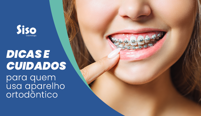 Dicas e cuidados para quem usa aparelho ortodôntico