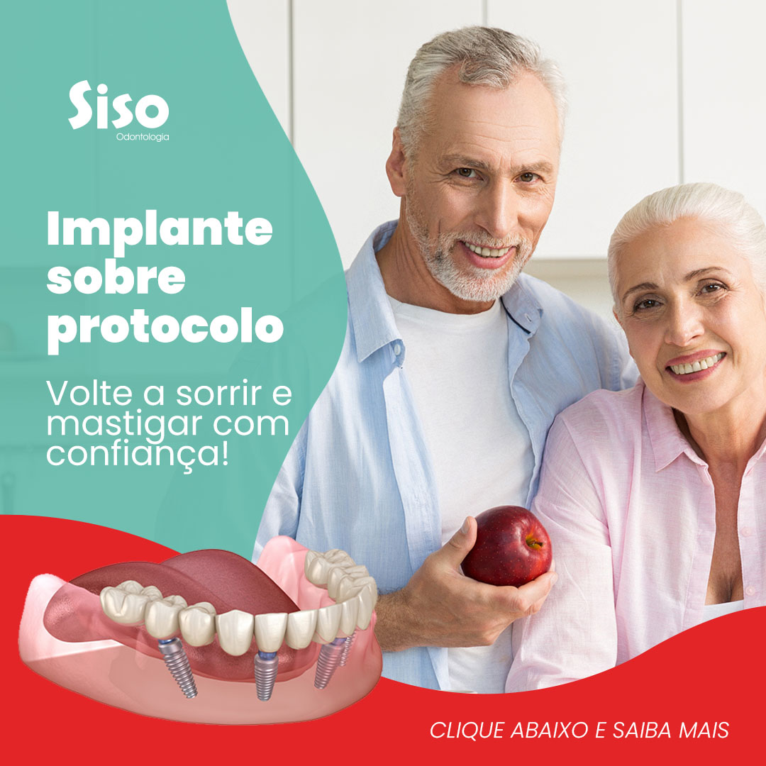 Implante sobre protocolo: volte a sorrir e mastigar com confiança Implante sobre protocolo: volte a sorrir e mastigar com confiança