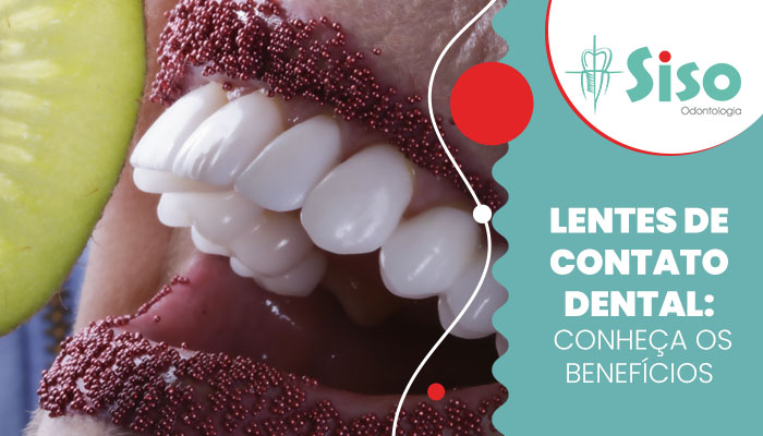 Lentes de contato dental: conheça os benefícios Lentes de contato dental: conheça os benefícios