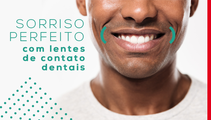 SORRISO PERFEITO COM LENTES DE CONTATO DENTAIS SORRISO PERFEITO COM LENTES DE CONTATO DENTAIS